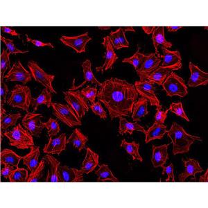Rhodamine-Phalloidin（罗丹明标记鬼笔环肽）| 细胞骨架荧光染料 | EnkiLife恩玑生命