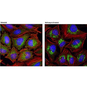 Lysosome Tracker (Green)（溶酶体绿色荧光探针）| 亚细胞结构荧光染料 | EnkiLife恩玑生命