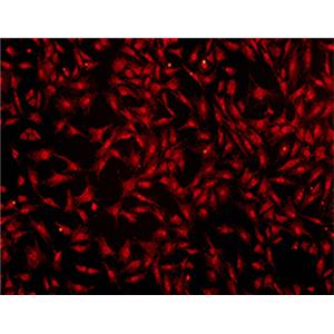 超氧化物阴离子荧光探针—DHE| 亚细胞结构荧光染料 | EnkiLife恩玑生命