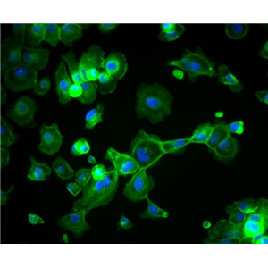 小鼠神经细胞瘤与大鼠神经胶质瘤之融合细胞NG108-15