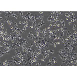 人非小细胞肺癌细胞NCI-H1299/LUC（STR鉴定） | EnkiLife恩玑生命