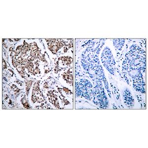 Bad (phospho Ser155) Rabbit Polyclonal Antibody | 兔多抗 | EnkiLife恩玑生命