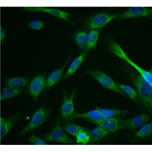 人宫颈癌细胞Hela