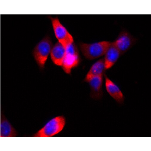 人宫颈癌组织源细胞