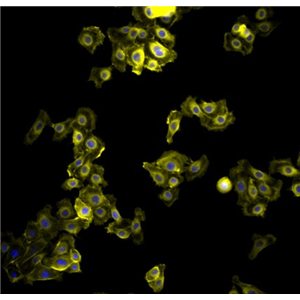 人宫颈口鳞状上皮-阴道上皮细胞Ect1/E6E7