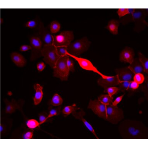 人骨骼肌卫星细胞
