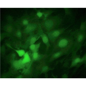 人骨肉瘤细胞MNNG/HOS Cl #5 [R-1059-D]