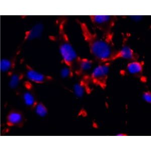 人骨肉瘤细胞SJSA-1