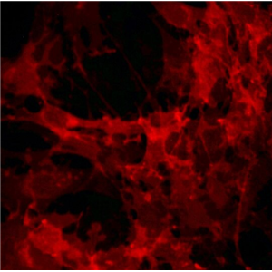 GP2d 人结肠癌细胞