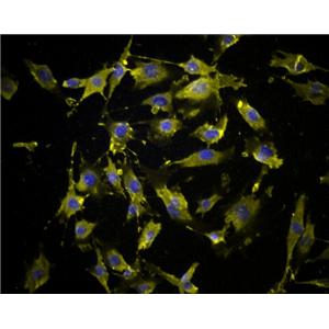 NCI-BL2009 人淋巴母细胞EBV 转化