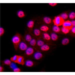 Nthy-ori 3-1 人甲状腺正常细胞