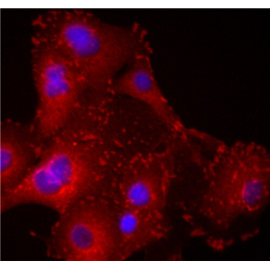 HCC70 人乳腺导管癌细胞