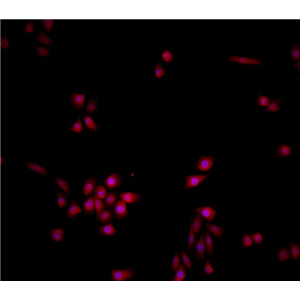 HCC38 BL 人淋巴母细胞EBV 转化
