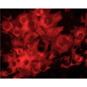 OVCA429 人卵巢癌细胞