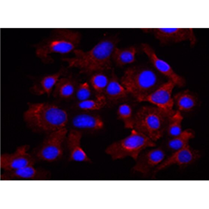 MCF-12A 人乳腺上皮细胞