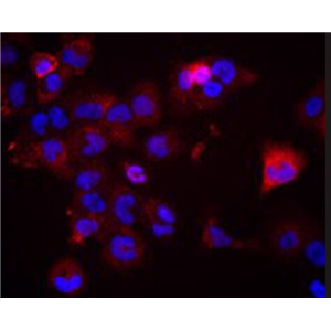 K7M2 wt [K7M2-WT]小鼠骨肉瘤成骨细胞