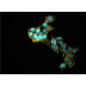 RAG小鼠肾腺癌细胞