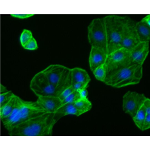 Y1小鼠肾上腺皮质瘤细胞