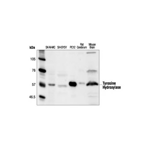 酪氨酸羟化酶抗体