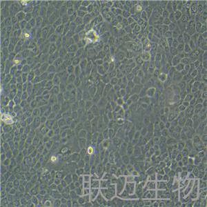 BxPC-3细胞（原位胰腺腺癌细胞STR鉴定正确）LM8C0042