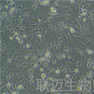 DU145细胞（人前列腺癌细胞STR鉴定正确）LM8C0075