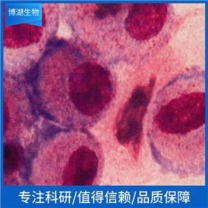 MH-22A小鼠肝癌22A细胞