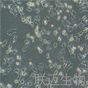 RH-35细胞（大鼠肝癌细胞种属鉴定正确）LM8C0195