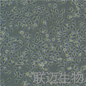 SMMC-7721细胞（肝癌细胞）LM8C0216
