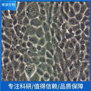 CHL中国仓鼠肺细胞