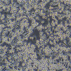 LA795细胞（小鼠肺腺癌细胞）LM8C0376